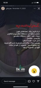 مرکز لیزر و لاغری دلوین خدمات دستگاه لاغری لیزر در تهران ازگل 14