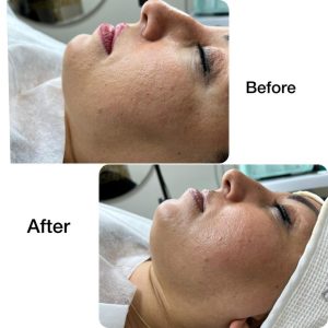 مرکز لیزر و لاغری دلوین خدمات دستگاه لاغری لیزر در تهران ازگل 3