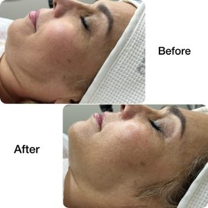 مرکز لیزر و لاغری دلوین خدمات دستگاه لاغری لیزر در تهران ازگل 4
