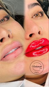 مرکز ‏فوق ‏ ‏تخصصی ‏میکروبلیدینگ ‏در ‏پیروزی