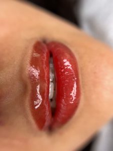 نوحه میکروبلیدینگ شیدینگ لب بن مژه در شهر مشهد وکیل آباد10