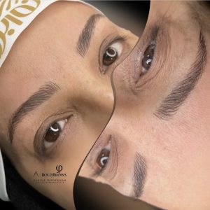 نوحه میکروبلیدینگ شیدینگ لب بن مژه در شهر مشهد وکیل آباد13