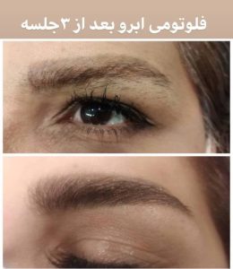 احمدی خدمات اصلاح ابرو و حجامت ابرو در تهران کامرانیه شمالی 12