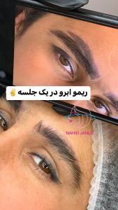 ناهید ‏جانلو ‏میکروبلیدینگ ‏بن ‏مژه ‏خط ‏چشم ‏دائم ‏در ‏ساری ‏پیام ‏نور 19