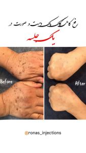 کلینیک تخصصی جوانسازی روناس رفع کک و مک رفع واریس در بوشهر باغ زهرا 11