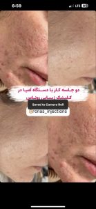 کلینیک تخصصی جوانسازی روناس رفع کک و مک رفع واریس در بوشهر باغ زهرا