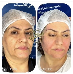 کلینیک تخصصی جوانسازی روناس رفع کک و مک رفع واریس در بوشهر باغ زهرا 4