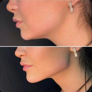 کلینیک نوشین درم ژل بوتاکس لیزر در شهرک غرب سعادت آباد میدان کاج 11