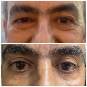 کلینیک نوشین درم ژل بوتاکس لیزر در شهرک غرب سعادت آباد میدان کاج 12