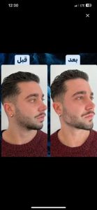 کلینیک نوشین درم ژل بوتاکس لیزر در شهرک غرب سعادت آباد میدان کاج 2