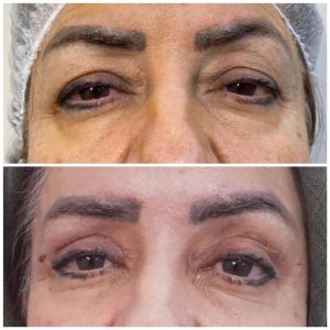 کلینیک نوشین درم ژل بوتاکس لیزر در شهرک غرب سعادت آباد میدان کاج 7