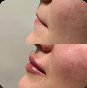 کلینیک نوشین درم ژل بوتاکس لیزر در شهرک غرب سعادت آباد میدان کاج 8