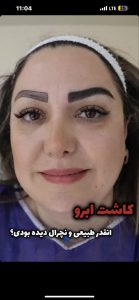 ‏تخصصی ‏جوانسازی ‏روناس ‏کاشت ‏ابرو ‏با ‏متد ‏شش ‏زاویه ‏لیزر ‏موتوس ‏در ‏بوشهر ‏باهنر