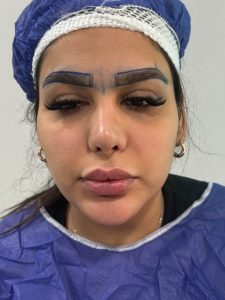 ‏تخصصی ‏جوانسازی ‏روناس ‏کاشت ‏ابرو ‏با ‏متد ‏شش ‏زاویه ‏لیزر ‏موتوس ‏در ‏بوشهر ‏باهنر 2