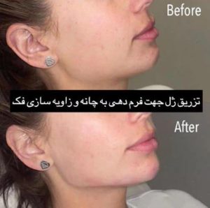 کلینیک ‏دکتر ‏نیلوفر ‏افخمی ‏هیرفیلر ‏پروفایلو ‏جالپرو ‏در ‏مشهد ‏سجاد ‏خیام 4