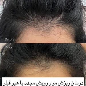 کلینیک ‏دکتر ‏نیلوفر ‏افخمی ‏هیرفیلر ‏پروفایلو ‏جالپرو ‏در ‏مشهد ‏سجاد ‏خیام 7