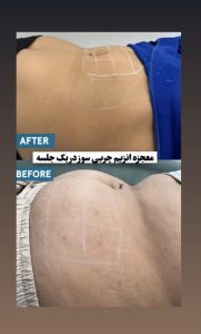 کلینیک ‏زیبایی ‏الینست ‏‏فیلر ‏‏باسن ‏‏جوانسازی ‏‏هایفوتراپی ‏‏در ‏‏تهران ‏‏پاسداران 4
