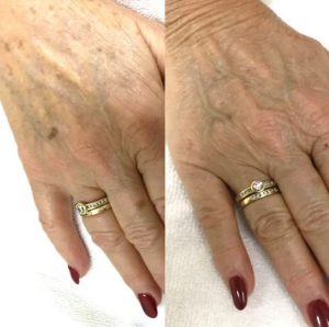 ‏زیبایی ‏مانیکا ‏تزریق ‏ژل ‏بوتاکس ‏فیلر ‏در ‏میدان ‏جمهوری 5