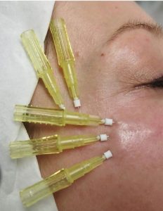 ‏زیبایی ‏مانیکا ‏تزریق ‏ژل ‏بوتاکس ‏فیلر ‏در ‏میدان ‏جمهوری 6