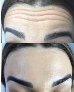 ‏زیبایی ‏مانیکا ‏تزریق ‏ژل ‏بوتاکس ‏فیلر ‏در ‏میدان ‏جمهوری 7