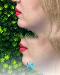 کلینیک ‏زیبایی ‏مینورا ‏کلینیک ‏مجهز ‏به ‏دستگاه ‏لاغری ‏کوتیشن ‏آرف ‏کریو ‏تخصصی ‏غبغب ‏در ‏شهرک ‏گلستان ‏بام ‏لند 18