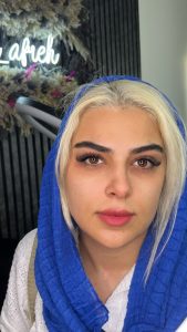 سالن آفره انواع بافت مو فیشال تخصصی پوست در پردیس فاز 1 3