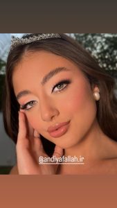 زیبایی آندیا فلاح میکرونیدلینگ میکرودرم آبریژن هیدرودرم آبریژن در کرج مهرشهر 11