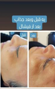 ‏و ‏آموزشگاه ‏زیبایی ‏نسیم ‏پرتو ‏درمانی ‏لیفت ‏و ‏جوانسازی ‏پوست ‏درمان ‏پسوریازیس ‏در ‏صادقیه ‏فردوس ‏ش 16