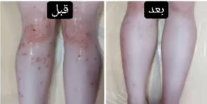 ‏و ‏آموزشگاه ‏زیبایی ‏نسیم ‏پرتو ‏درمانی ‏لیفت ‏و ‏جوانسازی ‏پوست ‏درمان ‏پسوریازیس ‏در ‏صادقیه ‏فردوس ‏ش 18