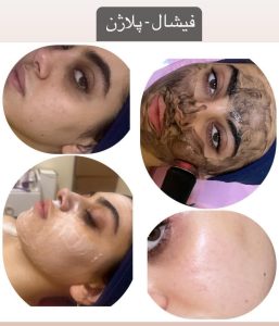 شیرین ‏اسکین ‏کر ‏خدمات ‏پاکسازی ‏پوست ‏اسیدتراپی ‏کربوکسی ‏تراپی ‏خدمات ‏پلاژن ‏تراپی ‏در ‏تهران ‏شهر ‏آرا 11