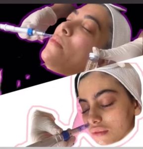 شیرین ‏اسکین ‏کر ‏خدمات ‏پاکسازی ‏پوست ‏اسیدتراپی ‏کربوکسی ‏تراپی ‏خدمات ‏پلاژن ‏تراپی ‏در ‏تهران ‏شهر ‏آرا 15