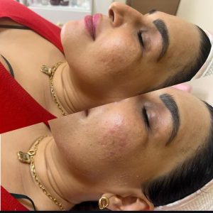 شیرین ‏اسکین ‏کر ‏خدمات ‏پاکسازی ‏پوست ‏اسیدتراپی ‏کربوکسی ‏تراپی ‏خدمات ‏پلاژن ‏تراپی ‏در ‏تهران ‏شهر ‏آرا 16