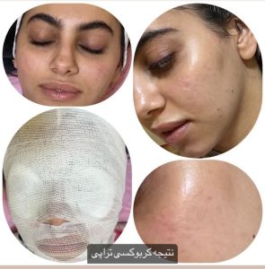 شیرین ‏اسکین ‏کر ‏خدمات ‏پاکسازی ‏پوست ‏اسیدتراپی ‏کربوکسی ‏تراپی ‏خدمات ‏پلاژن ‏تراپی ‏در ‏تهران ‏شهر ‏آرا 20