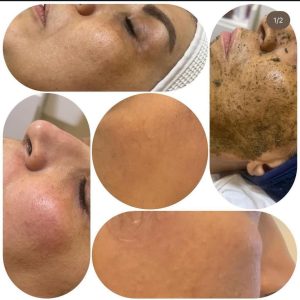 شیرین ‏اسکین ‏کر ‏خدمات ‏پاکسازی ‏پوست ‏اسیدتراپی ‏کربوکسی ‏تراپی ‏خدمات ‏پلاژن ‏تراپی ‏در ‏تهران ‏شهر ‏آرا