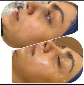 شیرین ‏اسکین ‏کر ‏خدمات ‏پاکسازی ‏پوست ‏اسیدتراپی ‏کربوکسی ‏تراپی ‏خدمات ‏پلاژن ‏تراپی ‏در ‏تهران ‏شهر ‏آرا 4