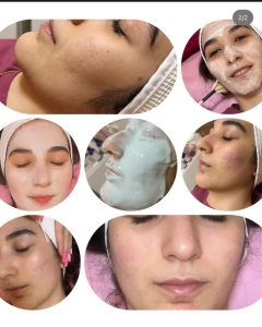 شیرین ‏اسکین ‏کر ‏خدمات ‏پاکسازی ‏پوست ‏اسیدتراپی ‏کربوکسی ‏تراپی ‏خدمات ‏پلاژن ‏تراپی ‏در ‏تهران ‏شهر ‏آرا 5