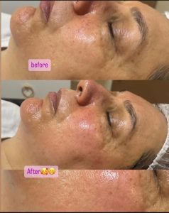 شیرین ‏اسکین ‏کر ‏خدمات ‏پاکسازی ‏پوست ‏اسیدتراپی ‏کربوکسی ‏تراپی ‏خدمات ‏پلاژن ‏تراپی ‏در ‏تهران ‏شهر ‏آرا 7