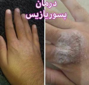 ‏و ‏درمانگر ‏طب ‏سلامت ‏بانو ‏نورمحمدی ‏تشخیص ‏عارضه ‏ها ‏از ‏روی ‏زبان ‏با ‏گیاه ‏درمانی ‏د 10