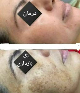 ‏و ‏درمانگر ‏طب ‏سلامت ‏بانو ‏نورمحمدی ‏تشخیص ‏عارضه ‏ها ‏از ‏روی ‏زبان ‏با ‏گیاه ‏درمانی ‏د 11