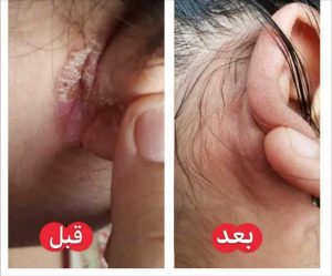 ‏و ‏درمانگر ‏طب ‏سلامت ‏بانو ‏نورمحمدی ‏تشخیص ‏عارضه ‏ها ‏از ‏روی ‏زبان ‏با ‏گیاه ‏درمانی ‏د 13