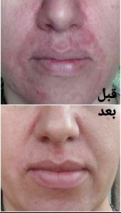 ‏و ‏درمانگر ‏طب ‏سلامت ‏بانو ‏نورمحمدی ‏تشخیص ‏عارضه ‏ها ‏از ‏روی ‏زبان ‏با ‏گیاه ‏درمانی ‏د 8