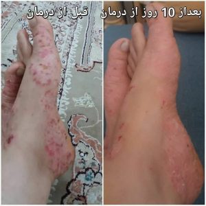 ‏و ‏درمانگر ‏طب ‏سلامت ‏بانو ‏نورمحمدی ‏تشخیص ‏عارضه ‏ها ‏از ‏روی ‏زبان ‏با ‏گیاه ‏درمانی ‏د 9