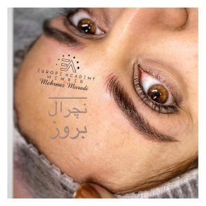 میکروبلیدینگ 7