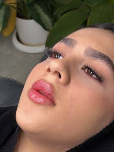 ‏زیبایی ‏توکا ‏ژل ‏بوتاکس ‏و ‏هایفو ‏لیزر ‏در ‏نازی ‏آباد 9
