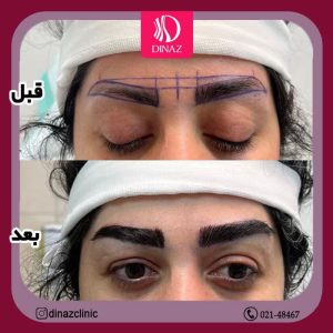 کلینیک ‏زیبایی ‏دیناز ‏خدمات ‏کاشت ‏مو ‏و ‏کاشت ‏ابرو ‏و ‏بلفاروپلاستی ‏در ‏تهران ‏سعادت ‏آباد ‏میدان ‏کتاب 11
