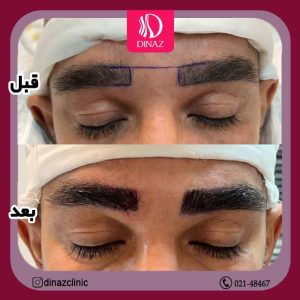 کلینیک ‏زیبایی ‏دیناز ‏خدمات ‏کاشت ‏مو ‏و ‏کاشت ‏ابرو ‏و ‏بلفاروپلاستی ‏در ‏تهران ‏سعادت ‏آباد ‏میدان ‏کتاب 12