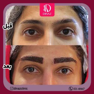 کلینیک ‏زیبایی ‏دیناز ‏خدمات ‏کاشت ‏مو ‏و ‏کاشت ‏ابرو ‏و ‏بلفاروپلاستی ‏در ‏تهران ‏سعادت ‏آباد ‏میدان ‏کتاب 13