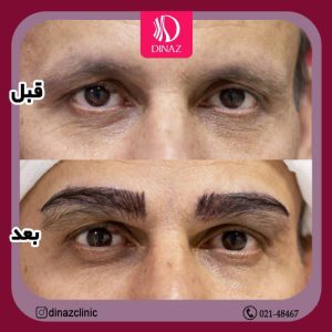 کلینیک ‏زیبایی ‏دیناز ‏خدمات ‏کاشت ‏مو ‏و ‏کاشت ‏ابرو ‏و ‏بلفاروپلاستی ‏در ‏تهران ‏سعادت ‏آباد ‏میدان ‏کتاب 14
