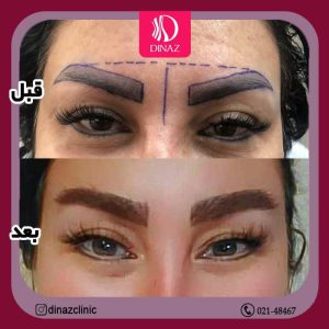 کلینیک ‏زیبایی ‏دیناز ‏خدمات ‏کاشت ‏مو ‏و ‏کاشت ‏ابرو ‏و ‏بلفاروپلاستی ‏در ‏تهران ‏سعادت ‏آباد ‏میدان ‏کتاب 15
