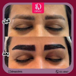 کلینیک ‏زیبایی ‏دیناز ‏خدمات ‏کاشت ‏مو ‏و ‏کاشت ‏ابرو ‏و ‏بلفاروپلاستی ‏در ‏تهران ‏سعادت ‏آباد ‏میدان ‏کتاب 16